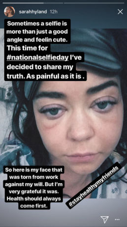 Modern aile Sarah Hyland hastaneye kaldırıldı ve şişmiş yüzünün acı bir Selfie paylaşıyor